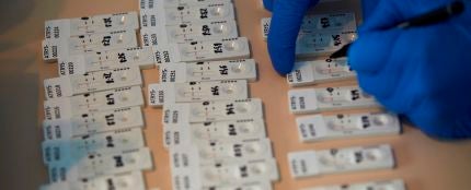 Imagen de los test rápidos para detectar anticuerpos