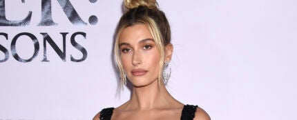 Hailey Bieber, hospitalizada tras sufrir los síntomas de un derrame cerebral: así se recupera